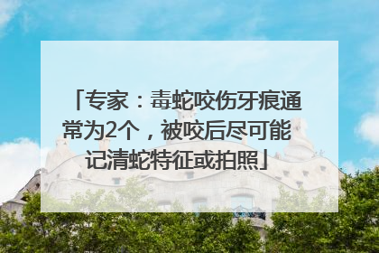 专家：毒蛇咬伤牙痕通常为2个，被咬后尽可能记清蛇特征或拍照